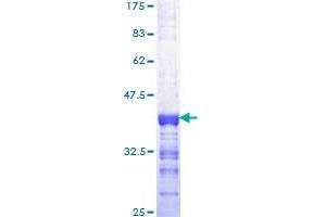 ELF1 Protein (AA 421-520) (GST tag)