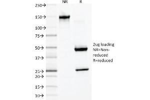 SDS-PAGE Analysis of Purified Desmin Monoclonal Antibody (DES/1711). (Desmin anticorps)