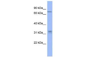 WB Suggested Anti-PRDM8 Antibody Titration:  0. (PRDM8 anticorps  (Middle Region))
