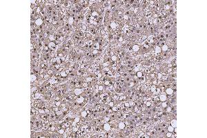 IHC analysis of TRIR using anti-TRIR antibody (ABIN7603244). (Uncharacterized Protein C19orf43 (TRIR) (N-Term) anticorps)