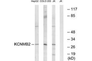 Western blot analysis of extracts from Jurkat/COLO/HepG2 cells, using KCNMB2 Antibody. (KCNMB2 anticorps  (AA 151-200))