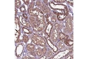 Immunohistochemical staining of human kidney with NARFL polyclonal antibody  shows strong cytoplasmic positivity in distal tubules at 1:200-1:500 dilution. (NARFL anticorps)