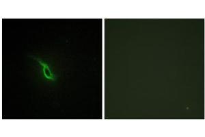 Immunofluorescence analysis of NIH/3T3 cells, using Adrenergic Receptor alpha -2A antibody. (ADRA2A anticorps  (C-Term))