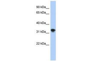 Image no. 1 for anti-Centromere Protein P (CENPP) (AA 35-84) antibody (ABIN6741259) (CENPP anticorps  (AA 35-84))