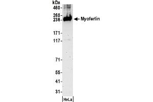anti-Myoferlin (MYOF) (AA 700-750) antibody