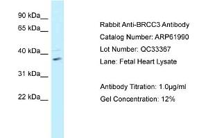 Western Blotting (WB) image for anti-BRCA1/BRCA2-Containing Complex, Subunit 3 (BRCC3) (C-Term) antibody (ABIN2788976) (BRCC3 anticorps  (C-Term))