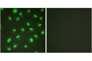 Immunofluorescence analysis of HuvEc cells, using p57 Kip2 (Ab-310) Antibody. (CDKN1C anticorps  (AA 267-316))