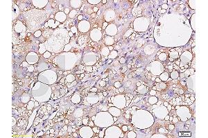 Formalin-fixed and paraffin embedded: rat liver labeled with Anti-Leptin Polyclonal Antibody (ABIN725030), Unconjugated 1:300 followed by conjugation to the secondary antibody and DAB staining (Leptin anticorps  (AA 101-154))