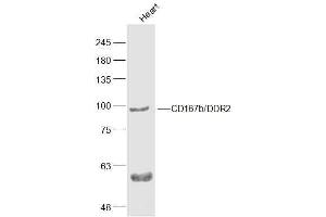 Mouse Heart lysates probed with CD167b'DDR2 Polyclonal Antibody, Unconjugated  at 1:500 dilution and 4˚C overnight incubation.