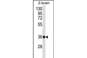 HOXD10 Antibody (C-term) (ABIN656539 and ABIN2845803) western blot analysis in zebra fish brain tissue lysates (35 μg/lane). (HOXD10 anticorps  (C-Term))