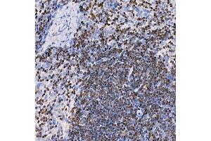Immunohistochemistry of paraffin-embedded mouse spleen using IKZF3 antibody (ABIN7267842) at dilution of 1:100 (40x lens).