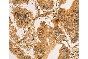Immunohistochemistry (IHC) image for anti-Ribosomal Protein L26-Like 1 (RPL26L1) antibody (ABIN2422743) (RPL26L1 anticorps)