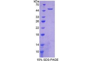 SDS-PAGE (SDS) image for High Temperature Requirement Factor A1 (AA 204-364) protein (His tag,GST tag) (ABIN1099162) (High Temperature Requirement Factor A1 (AA 204-364) protein (His tag,GST tag))