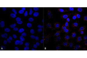 Immunocytochemistry/Immunofluorescence analysis using Mouse Anti-VPS35 Monoclonal Antibody, Clone 5A9 (ABIN6932953).