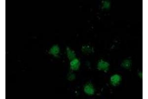 Anti-DSTN mouse monoclonal antibody (ABIN2454364) immunofluorescent staining of COS7 cells transiently transfected by pCMV6-ENTRY DSTN (RC203419). (Destrin anticorps)