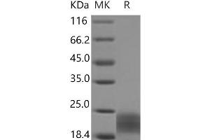 Western Blotting (WB) image for PDGF-BB Homodimer (Active) protein (His tag) (ABIN7197388) (PDGF-BB Homodimer (Active) protein (His tag))