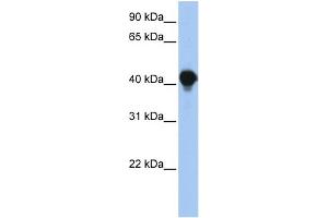 WB Suggested Anti-PTPLAD1 Antibody Titration:  0. (PTPLAD1 anticorps  (N-Term))
