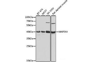 Western blot analysis of extracts of various cell lines using MAP2K4 Polyclonal Antibody at dilution of 1:1000. (MAP2K4 anticorps)