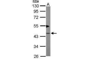 WB Image Sample (50 ug of whole cell lysate) A: Mouse brain 10% SDS PAGE antibody diluted at 1:1000 (PKA 2 beta (Center) anticorps)