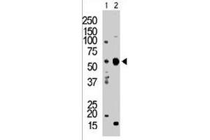 The PACSIN2 polyclonal antibody  is used in Western blot to detect PACSIN2 in T-47D cell lysate (Lane 1) and mouse brain tissue lysate (Lane 2) . (PACSIN2 anticorps  (C-Term))