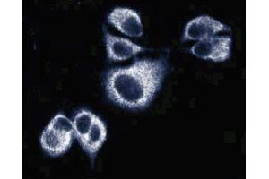 Immunofluorescence of AN3 CA cells (Human endometrial adenocarcinoma, ATCC HTB-111). (Sec8 anticorps  (AA 31-201))