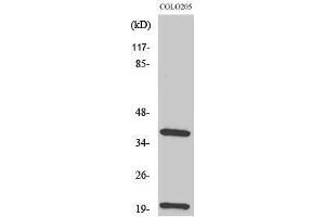 Western Blotting (WB) image for anti-T Cell Receptor (TCR) beta (TCR beta) (Internal Region) antibody (ABIN3180910)