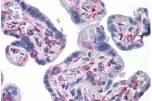 Human Placenta: Formalin-Fixed, Paraffin-Embedded (FFPE)