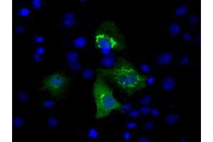 Immunofluorescence (IF) image for anti-Induced Myeloid Leukemia Cell Differentiation Protein Mcl-1 (MCL1) antibody (ABIN1499344) (MCL-1 anticorps)