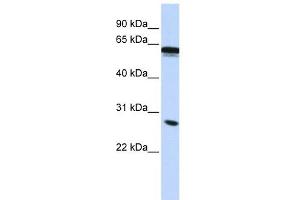 IGSF1 antibody used at 1 ug/ml to detect target protein.