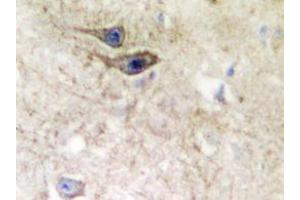 Immunohistochemistry analyzes of EphB1/2 antibody in paraffin-embedded human brain tissue. (EPH Receptor B1 anticorps)
