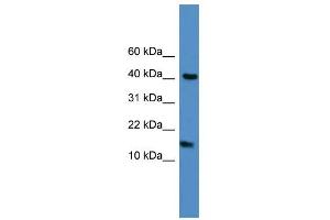 WB Suggested Anti-LCN1 Antibody Titration: 0.