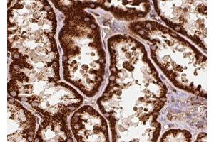 ABIN6272916 at 1/100 staining Human kidney tissue by IHC-P. (ERAL1 anticorps  (Internal Region))