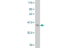 Western Blot detection against Immunogen (37. (STMN2 anticorps  (AA 73-179))