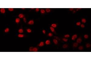 ABIN6266861 staining MDA-MB-435 by IF/ICC.