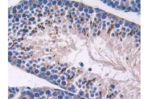 DAB staining on IHC-P; Samples: Mouse Testis Tissue (SPARC anticorps  (AA 18-302))