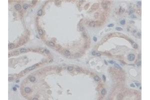 Detection of CF6 in Human Kidney Tissue using Polyclonal Antibody to Coupling Factor 6 (CF6)