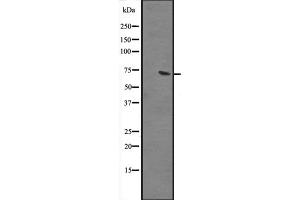 Western blot analysis of GBP2 expression in human liver tissue lysate ;,The lane on the left is treated with the antigen-specific peptide. (GBP2 anticorps  (Internal Region))