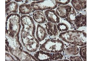 Image no. 1 for anti-NADH Dehydrogenase (Ubiquinone) 1 beta Subcomplex, 10, 22kDa (NDUFB10) antibody (ABIN1499668)