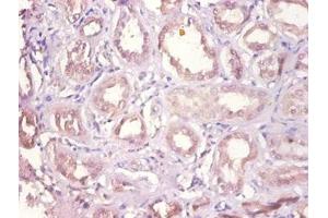 Immunohistochemistry of paraffin-embedded human kidney tissue using ABIN7149627 at dilution of 1:100 (DHRS9 anticorps  (AA 23-319))