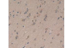 Used in DAB staining on fromalin fixed paraffin- embedded Kidney tissue (Neurocan anticorps  (AA 1008-1273))
