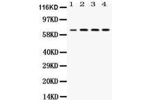 Western blot analysis of YY1 expression in rat lung extract (lane 1), JURKAT whole cell lysates (lane 2), CEM whole cell lysates (lane 3) and HEPG2 whole cell lysates (lane 4). (YY1 anticorps  (Middle Region))