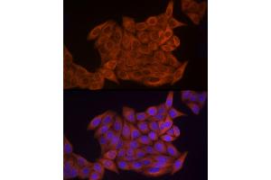 Immunofluorescence analysis of HeLa cells using Thymidine Kinase 1 Rabbit pAb (ABIN6132726, ABIN6149198, ABIN6149199 and ABIN6221245) at dilution of 1:150 (40x lens).