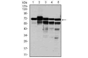 Image no. 7 for anti-Replication Protein A1, 70kDa (RPA1) antibody (ABIN1500741)