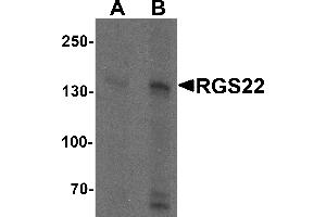 Western blot analysis of RGS22 in Jurkat cell lysate with RGS22 antibody at (A) 1 and (B) 2 µg/mL. (RGS22 anticorps  (N-Term))