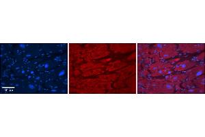 Rabbit Anti-TRIM10 Antibody    Formalin Fixed Paraffin Embedded Tissue: Human Adult heart  Observed Staining: Cytoplasmic Primary Antibody Concentration: 1:100 Secondary Antibody: Donkey anti-Rabbit-Cy2/3 Secondary Antibody Concentration: 1:200 Magnification: 20X Exposure Time: 0. (TRIM10 anticorps  (N-Term))