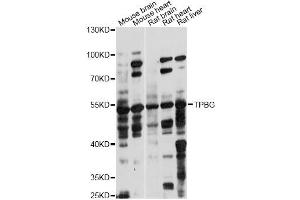 Western blot analysis of extracts of various cell lines, using TPBG antibody (ABIN6291221) at 1:1000 dilution. (TPBG anticorps)