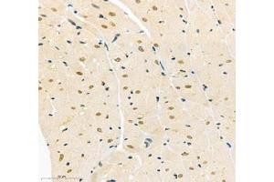 Immunohistochemistry of paraffin embedded rat heart using TEAD3 (ABIN7075852) at dilution of 1: 700 (400x lens)