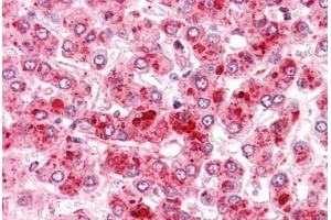 Human Liver: Formalin-Fixed, Paraffin-Embedded (FFPE) (COMT anticorps  (N-Term))