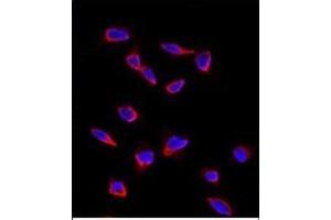 Immunofluorescence analysis of anti-SOX9 Antibody (N-term) in HeLa cells. (SOX9 anticorps  (N-Term))