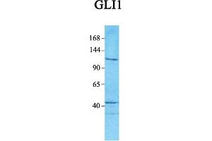 Host:  Rabbit  Target Name:  GLI1  Sample Tissue:  Human Jurkat  Antibody Dilution:  1.